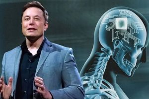 Elon Musks brain chip startup