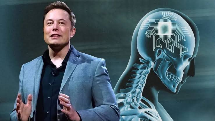 Elon Musks brain chip startup